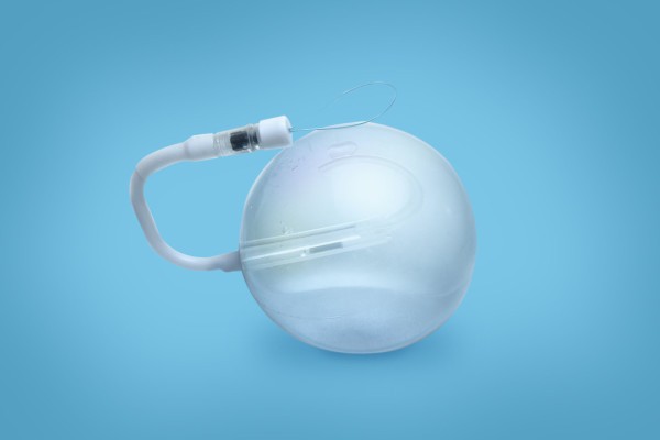 Câncer de Esôfago 5 O balão intragástrico é um tratamento minimamente invasivo indicado para auxiliar no emagrecimento de forma segura e controlada. O procedimento é realizado por endoscopia, sem cortes, onde um balão de silicone é posicionado dentro do estômago e preenchido, ocupando parte do seu volume. Com isso, o paciente passa a sentir saciedade mais rapidamente, reduzindo a quantidade de alimentos ingeridos.