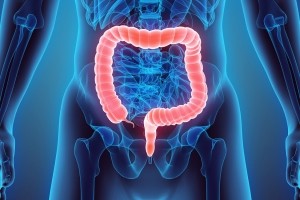 Diverticulos do Colon