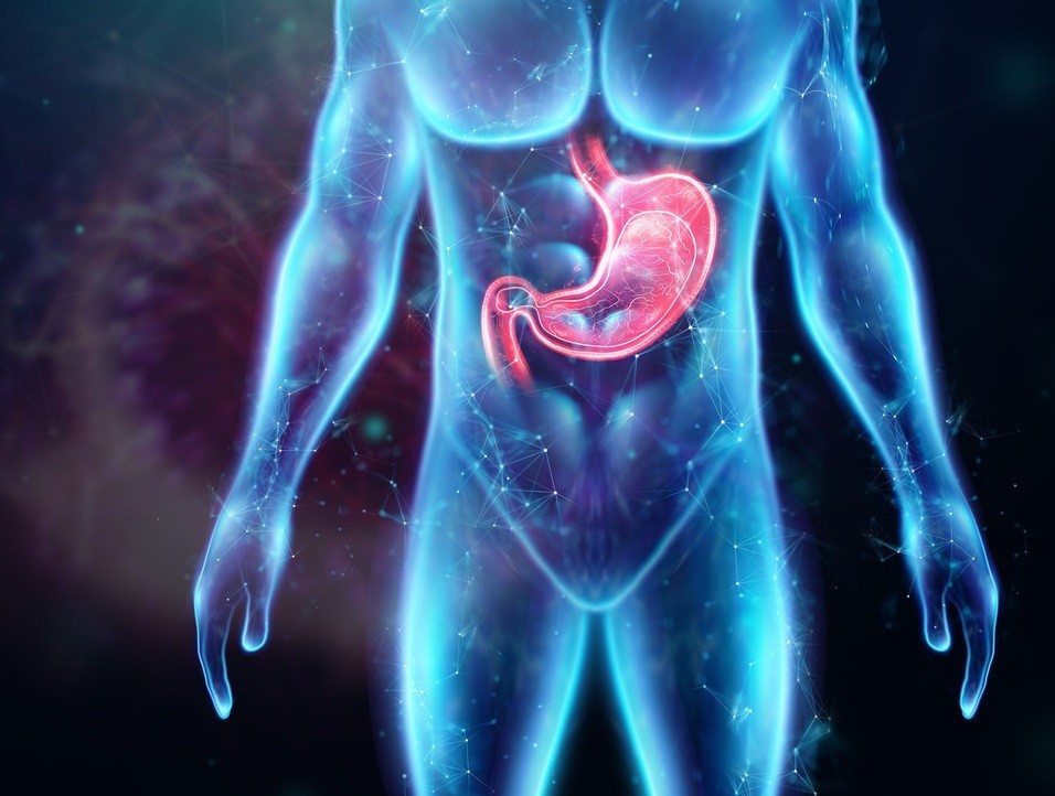 Pólipo do Estômago