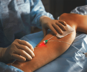 laser endovenoso angioskope