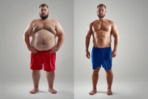 Obesidade 2