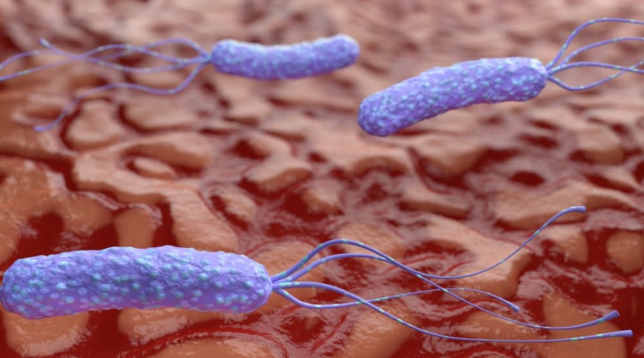 Helicobacter Pylori (H. Pylori)