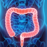 Divertículos do Cólon 42 image 14