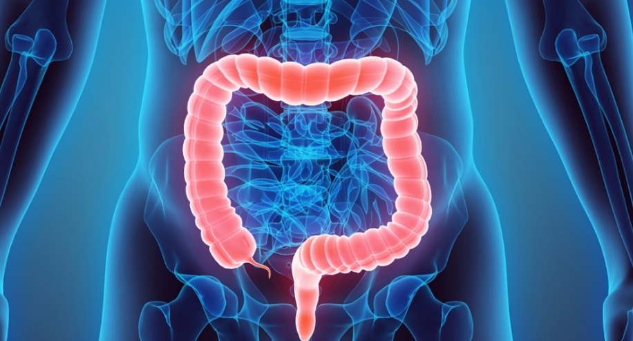 Divertículos do Cólon