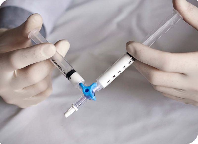 O tratamento de hemorroidas com microespuma é uma alternativa moderna e minimamente invasiva para pacientes que desejam tratar o problema sem a necessidade de cirurgia tradicional