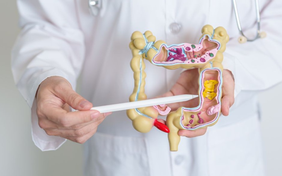 Câncer de Esôfago 1 Retossigmoidoscopia Exame realizado com sedação, semelhante à colonoscopia, porém usado para a investigação de patologias da porção mais distal do intestino grosso.