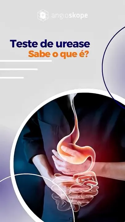 Teste de urease na Clínica Angioskope